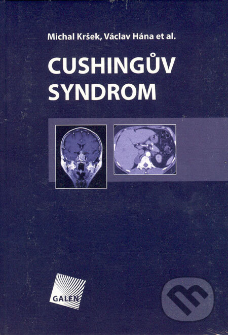 Kniha: Cushingův syndrom (Michal Kršek a Václav Hána). Galén, 2006 Kniha: Cushingův syndrom (Michal Kršek a Václav Hána). Galén, 2006