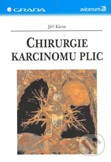 Kniha: Chirurgie karcinomu plic (Jiří Klein). Grada, 2006 Kniha: Chirurgie karcinomu plic (Jiří Klein). Grada, 2006