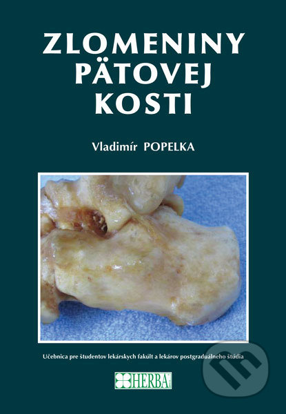 Kniha: Zlomeniny pätovej kosti (Vladimír Popelka). Herba, 2016 Kniha: Zlomeniny pätovej kosti (Vladimír Popelka). Herba, 2016