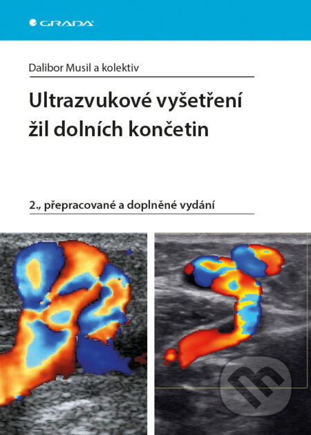 E-kniha: Ultrazvukové vyšetření žil dolních končetin (Dalibor Musil a kolektiv). Grada, 2016 E-kniha: Ultrazvukové vyšetření žil dolních končetin (Dalibor Musil a kolektiv). Grada, 2016
