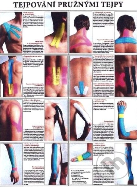 Mapa - Tejpování pružnými tejpy (Anna Velíšková). Poznání, 2019 Mapa - Tejpování pružnými tejpy (Anna Velíšková). Poznání, 2019