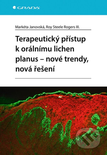 Kniha: Terapeutický přístup k orálnímu lichen planus - nové trendy, nová řešení (Markéta Janovská a Rogers III. Roy Steele). Grada, 2024 Kniha: Terapeutický přístup k orálnímu lichen planus - nové trendy, nová řešení (Markéta Janovská a Rogers III. Roy Steele). Grada, 2024