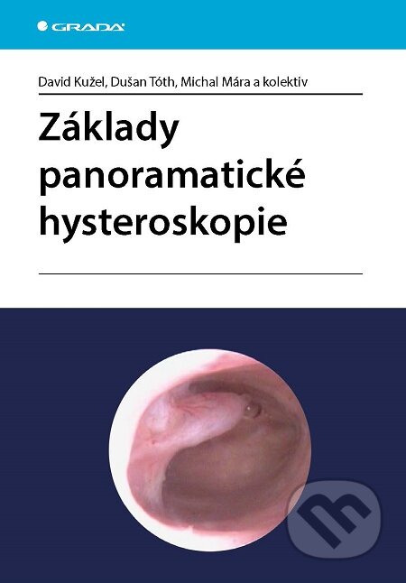 E-kniha: Základy panoramatické hysteroskopie (David Kužel, Dušan Tóth, Michal Mára a kolektív). Grada, 2016 E-kniha: Základy panoramatické hysteroskopie (David Kužel, Dušan Tóth, Michal Mára a kolektív). Grada, 2016