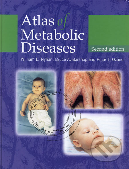 Kniha: Atlas of Metabolic Diseases (Bruce A. Barshop, Pinar T. Ozand a William L. Nyhan). Hodder Arnold, 2005 Kniha: Atlas of Metabolic Diseases (Bruce A. Barshop, Pinar T. Ozand a William L. Nyhan). Hodder Arnold, 2005