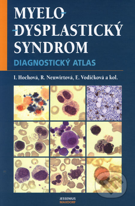 Kniha: Myelodysplastický syndrom (Elena Vodičková, Ivana Hochová, Radana Neuwirtová a kolektív). Maxdorf, 2006 Kniha: Myelodysplastický syndrom (Elena Vodičková, Ivana Hochová, Radana Neuwirtová a kolektív). Maxdorf, 2006