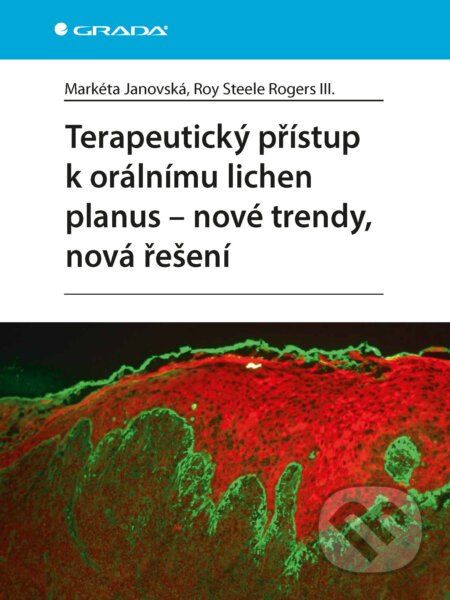 E-kniha: Terapeutický přístup k orálnímu lichen planus - nové trendy, nová řešení (Markéta Janovská a Roy Steele Rogers III.). Grada, 2024 E-kniha: Terapeutický přístup k orálnímu lichen planus - nové trendy, nová řešení (Markéta Janovská a Roy Steele Rogers III.). Grada, 2024