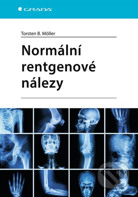 Kniha: Normální rentgenové nálezy (Torsten B. Möller). Grada, 2024 Kniha: Normální rentgenové nálezy (Torsten B. Möller). Grada, 2024