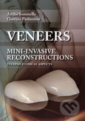 Kniha: Veneers (Attilio Sommella a Guerino Paolantoni). Teamwork Media, 2014 Kniha: Veneers (Attilio Sommella a Guerino Paolantoni). Teamwork Media, 2014