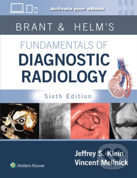 Kniha: Brant And Helms Fundamentals Of Diagnos (MD, Jeffrey, FACR Klein a Vincent Mellnick). Wolters Kluwer Health, 2024 Kniha: Brant And Helms Fundamentals Of Diagnos (MD, Jeffrey, FACR Klein a Vincent Mellnick). Wolters Kluwer Health, 2024