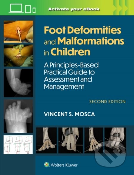 Kniha: Foot Deformities and Malformations in Children (Vincent Mosca). Wolters Kluwer Health, 2025 Kniha: Foot Deformities and Malformations in Children (Vincent Mosca). Wolters Kluwer Health, 2025