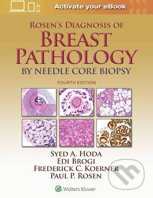 Rosen&#039;s Diagnosis of Breast Pathology by Needle Core Biopsy - Syed A. Hoda a kol., Lippincott Williams & Wilkins, 2017