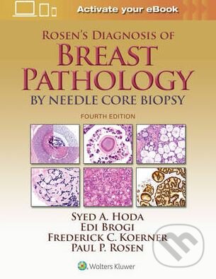 Kniha: Rosen's Diagnosis of Breast Pathology by Needle Core Biopsy (Syed A. Hoda). Lippincott Williams & Wilkins, 2017 Kniha: Rosen's Diagnosis of Breast Pathology by Needle Core Biopsy (Syed A. Hoda). Lippincott Williams & Wilkins, 2017