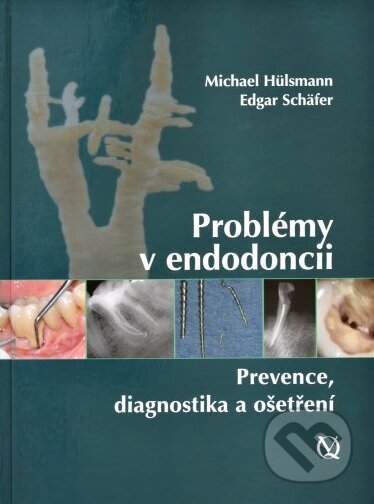 Kniha: Problémy v endodoncii (Edgar Schäfer a Michael Hülsmann). Quintessence, 2017 Kniha: Problémy v endodoncii (Edgar Schäfer a Michael Hülsmann). Quintessence, 2017