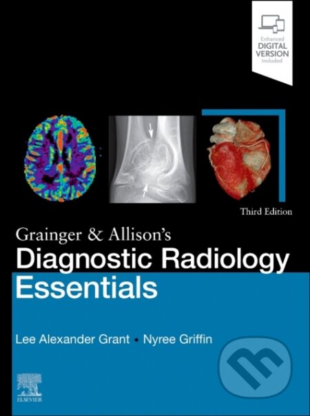 Kniha: Grainger & Allison's Diagnostic Radiology Essentials (Lee A. Grant a Nyree Griffin). Elsevier Science, 2024 Kniha: Grainger & Allison's Diagnostic Radiology Essentials (Lee A. Grant a Nyree Griffin). Elsevier Science, 2024