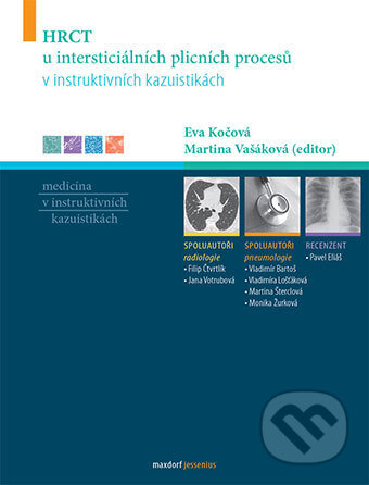Kniha: HRCT u intersticiálních plicních procesů v instruktivních kazuistikách (Eva Kočová). Maxdorf, 2017 Kniha: HRCT u intersticiálních plicních procesů v instruktivních kazuistikách (Eva Kočová). Maxdorf, 2017