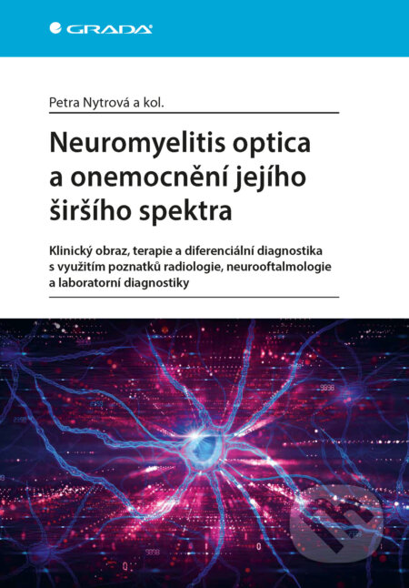 E-kniha: Neuromyelitis optica a poruchy jejího širšího spektra (Nytrová Petra a kolektiv). Grada, 2024 E-kniha: Neuromyelitis optica a poruchy jejího širšího spektra (Nytrová Petra a kolektiv). Grada, 2024