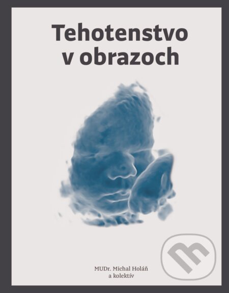 Kniha: Tehotenstvo v obrazoch (Michal Holáň a kolektiv). Fortuna Libri, 2018 Kniha: Tehotenstvo v obrazoch (Michal Holáň a kolektiv). Fortuna Libri, 2018