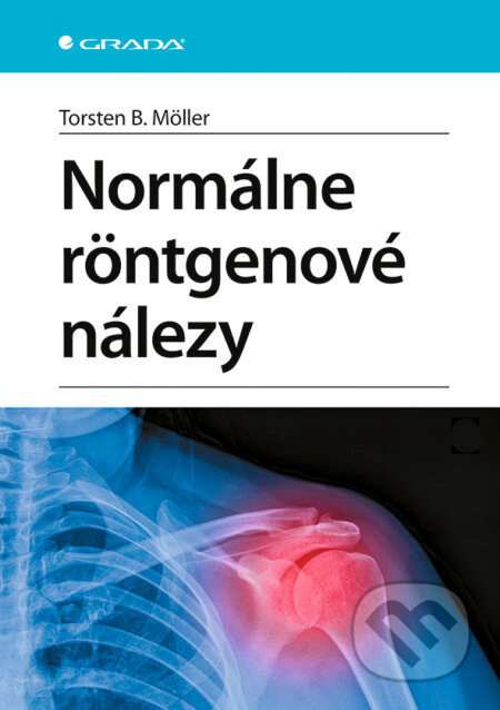 Kniha: Normálne röntgenové nálezy (Torsten B. Möller). Grada, 2026 Kniha: Normálne röntgenové nálezy (Torsten B. Möller). Grada, 2026