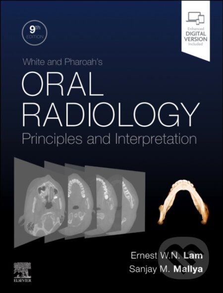 Kniha: White and Pharoah's Oral Radiology (Ernest Lam a Sanjay Mallya). Elsevier Science, 2025 Kniha: White and Pharoah's Oral Radiology (Ernest Lam a Sanjay Mallya). Elsevier Science, 2025
