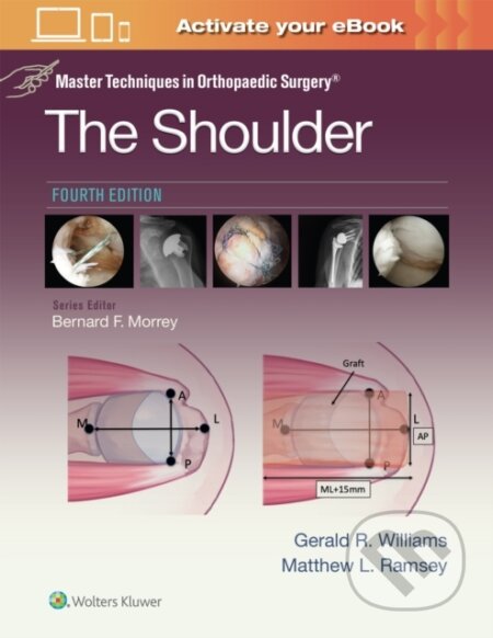 Kniha: Master Techniques in Orthopaedic Surgery: The Shoulder (Gerald R. Williams Jr. a Matthew L. Ramsey). Wolters Kluwer Health, 2025 Kniha: Master Techniques in Orthopaedic Surgery: The Shoulder (Gerald R. Williams Jr. a Matthew L. Ramsey). Wolters Kluwer Health, 2025