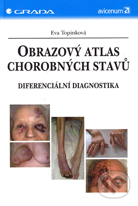 Kniha: Obrazový atlas chorobných stavů (Eva Topinková). Grada, 2006 Kniha: Obrazový atlas chorobných stavů (Eva Topinková). Grada, 2006