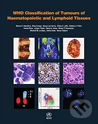 Kniha: WHO Classification of Tumours of Haematopoietic and Lymphoid Tissues (World Health Organization). World Health Organization, 2017 Kniha: WHO Classification of Tumours of Haematopoietic and Lymphoid Tissues (World Health Organization). World Health Organization, 2017