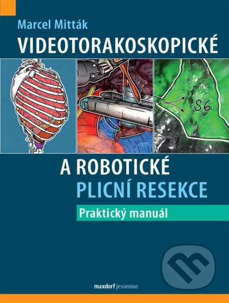 Kniha: Videotorakoskopické a robotické plicní resekce (Marcel Mitták). Maxdorf, 2025 Kniha: Videotorakoskopické a robotické plicní resekce (Marcel Mitták). Maxdorf, 2025