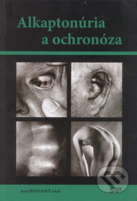 Kniha: Alkaptonúria a ochronóza (Jozef Rovenský). Slovak Academic Press, 2011 Kniha: Alkaptonúria a ochronóza (Jozef Rovenský). Slovak Academic Press, 2011