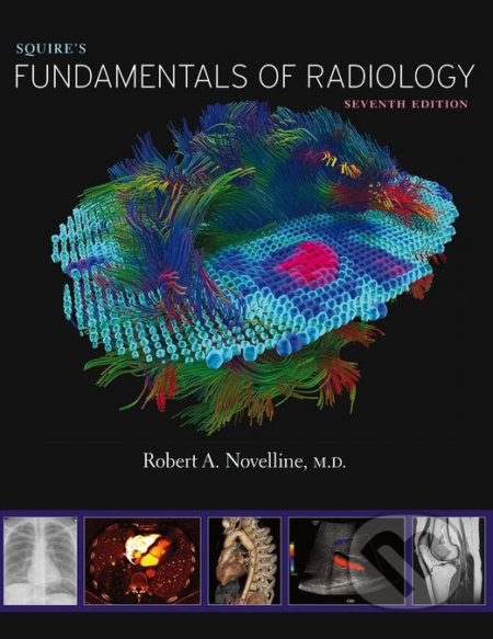 Kniha: Squires Fundamentals of Radiology (Robert A. Novelline). Harvard Business Press, 2018 Kniha: Squires Fundamentals of Radiology (Robert A. Novelline). Harvard Business Press, 2018
