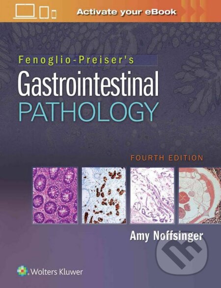Kniha: Fenoglio-Preiser's Gastrointestinal Pathology (Amy Noffsinger). Lippincott Williams & Wilkins, 2017 Kniha: Fenoglio-Preiser's Gastrointestinal Pathology (Amy Noffsinger). Lippincott Williams & Wilkins, 2017