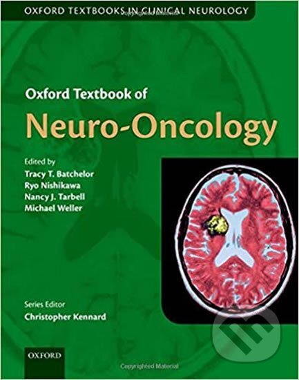 Kniha: Oxford Textbook of Neuro-Oncology (Michael Weller, Nancy J. Tarbell, Ryo Nishikawa a Tracy Batchelor). , 2017 Kniha: Oxford Textbook of Neuro-Oncology (Michael Weller, Nancy J. Tarbell, Ryo Nishikawa a Tracy Batchelor). , 2017