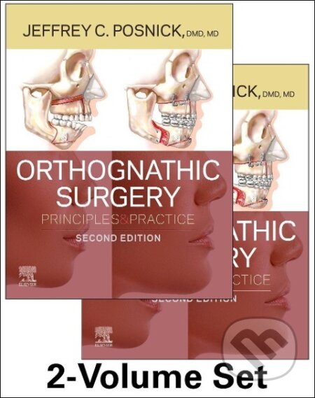 Kniha: Orthognathic Surgery - 2 Volume Set (Jeffrey C. Posnick). , 2022 Kniha: Orthognathic Surgery - 2 Volume Set (Jeffrey C. Posnick). , 2022
