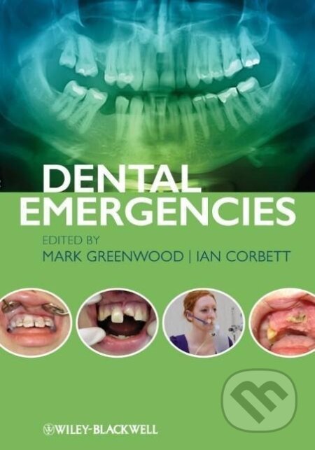Kniha: Greenwood, M: Dental Emergencies (Mark Greenwood). Wiley-Blackwell, 2012 Kniha: Greenwood, M: Dental Emergencies (Mark Greenwood). Wiley-Blackwell, 2012