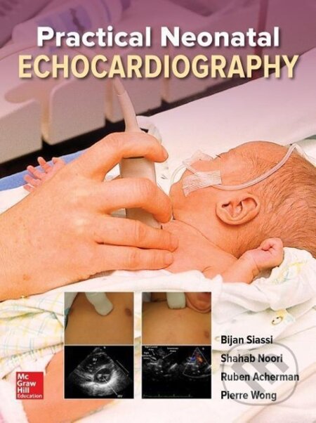 Kniha: Practical Neonatal Echocardiography (Bijan Siassi, Pierre Wong, Ruben Acherman a Shahab Noori). McGraw-Hill, 2018 Kniha: Practical Neonatal Echocardiography (Bijan Siassi, Pierre Wong, Ruben Acherman a Shahab Noori). McGraw-Hill, 2018