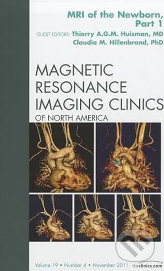 Kniha: MRI of the Newborn, Part 1, An Issue of Magnetic Resonance Imaging Clinics (A. Thierry Huisman). Saunders, 2012 Kniha: MRI of the Newborn, Part 1, An Issue of Magnetic Resonance Imaging Clinics (A. Thierry Huisman). Saunders, 2012