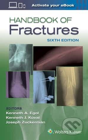 Kniha: Handbook of Fractures 6e (Kenneth MD Egol). , 2019 Kniha: Handbook of Fractures 6e (Kenneth MD Egol). , 2019