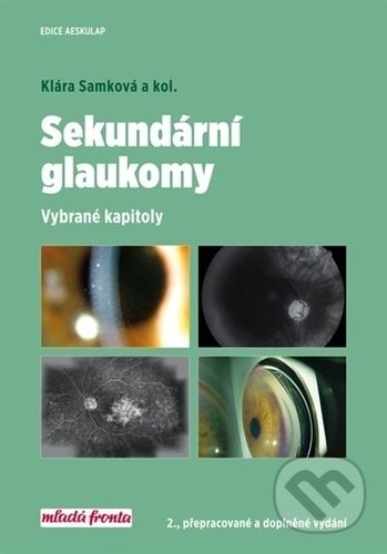 Kniha: Sekundární glaukomy (Klára Samková). Mladá fronta, 2018 Kniha: Sekundární glaukomy (Klára Samková). Mladá fronta, 2018