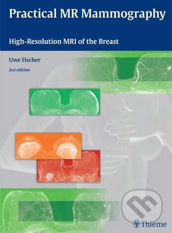 Kniha: Practical MR Mammography (Uwe Fischer). Thieme, 2012 Kniha: Practical MR Mammography (Uwe Fischer). Thieme, 2012