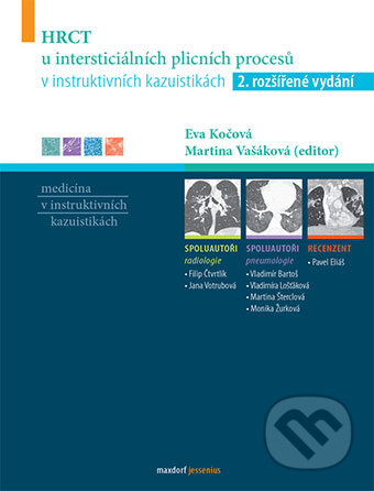 Kniha: HRCT u intersticiálních plicních procesů v instruktivních kazuistikách (Eva Kočová a Martina Vašáková). Maxdorf, 2018 Kniha: HRCT u intersticiálních plicních procesů v instruktivních kazuistikách (Eva Kočová a Martina Vašáková). Maxdorf, 2018