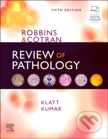 Kniha: Robbins and Cotran Review of Pathology, 5th Edition (Edward C. Klatt a Vinay Kumar). Elsevier Science, 2021 Kniha: Robbins and Cotran Review of Pathology, 5th Edition (Edward C. Klatt a Vinay Kumar). Elsevier Science, 2021