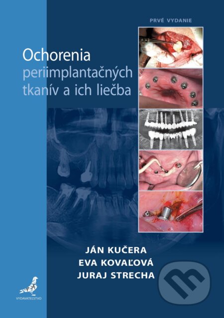 Kniha: Ochorenia periimplantačných tkanív a ich liečba (Juraj Strecha, Eva Kovaľová a Ján Kučera). Tlačiareň P+M, 2025 Kniha: Ochorenia periimplantačných tkanív a ich liečba (Juraj Strecha, Eva Kovaľová a Ján Kučera). Tlačiareň P+M, 2025