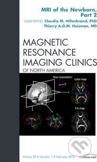 Kniha: MRI of the Newborn, Part 2, An Issue of Magnetic Resonance Imaging Clinics (A. Thierry Huisman). Saunders, 2012 Kniha: MRI of the Newborn, Part 2, An Issue of Magnetic Resonance Imaging Clinics (A. Thierry Huisman). Saunders, 2012