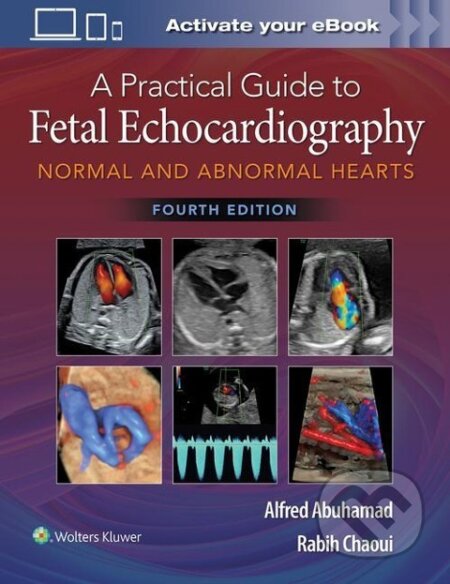 Kniha: A Practical Guide to Fetal Echocardiography (Alfred Z. Abuhamad). , 2022 Kniha: A Practical Guide to Fetal Echocardiography (Alfred Z. Abuhamad). , 2022