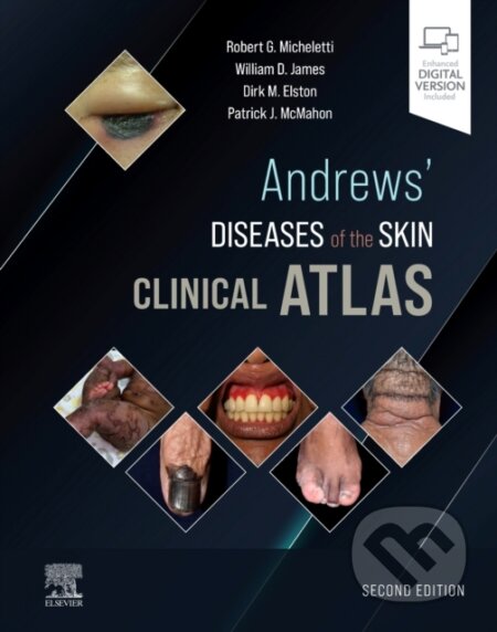 Kniha: Andrews' Diseases of the Skin Clinical Atlas, 2nd Edition (Elston & McMahon, James a Micheletti). Elsevier Science, 2022 Kniha: Andrews' Diseases of the Skin Clinical Atlas, 2nd Edition (Elston & McMahon, James a Micheletti). Elsevier Science, 2022