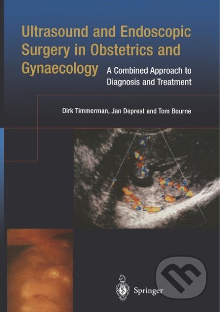 Kniha: Ultrasound and Endoscopic Surgery in Obstetrics and Gynaecology (Dirk Timmerman). Springer London, 2002 Kniha: Ultrasound and Endoscopic Surgery in Obstetrics and Gynaecology (Dirk Timmerman). Springer London, 2002