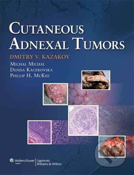 Kniha: Cutaneous Adnexal Tumors (V. Dmitry Kazakov). Lippincott Williams & Wilkins, 2012 Kniha: Cutaneous Adnexal Tumors (V. Dmitry Kazakov). Lippincott Williams & Wilkins, 2012