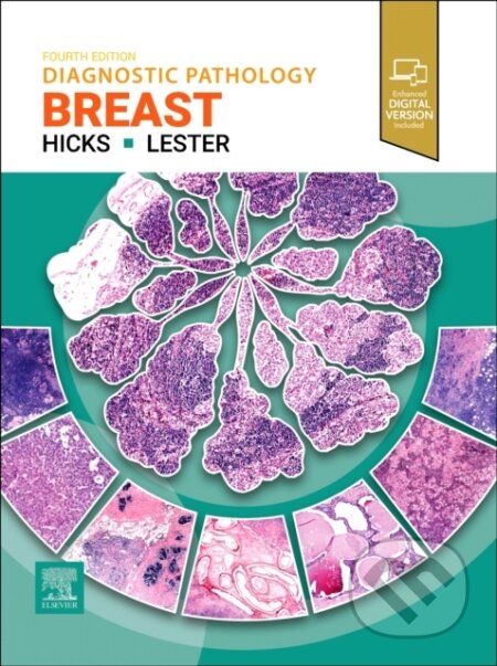 Kniha: Diagnostic Pathology: Breast (Susan C. Lester a David G. Hicks). Churchill Livingstone, 2025 Kniha: Diagnostic Pathology: Breast (Susan C. Lester a David G. Hicks). Churchill Livingstone, 2025