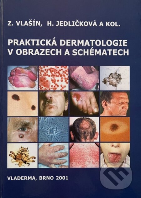 Kniha: Praktická dermatologie v obrazech a schématech (Zdeněk Vlašín a Hana Jedličková). Maxdorf, 2025 Kniha: Praktická dermatologie v obrazech a schématech (Zdeněk Vlašín a Hana Jedličková). Maxdorf, 2025