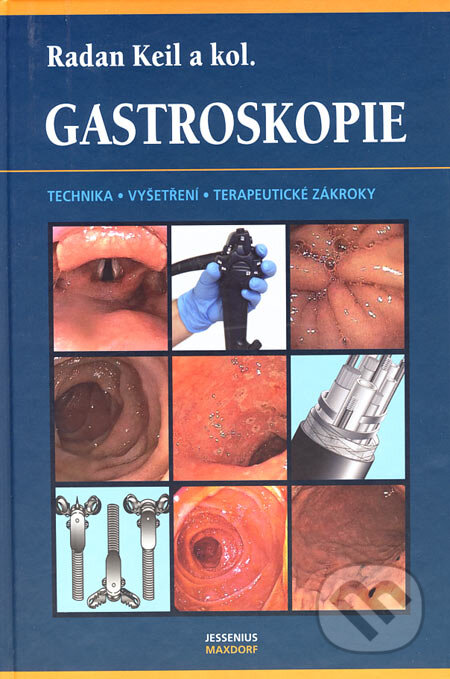 Gastroskopie - Keil, Radan a kol., Maxdorf, 2006