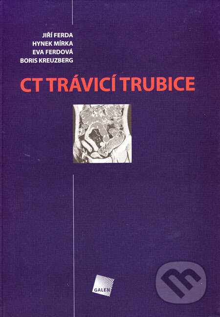 Kniha: CT trávicí trubice (Jiří Ferda a kolektiv). Galén, 2006 Kniha: CT trávicí trubice (Jiří Ferda a kolektiv). Galén, 2006